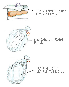 잘려나간 부분의 처치